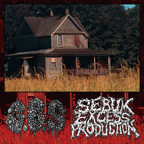 Sebum Excess Production : G.B.S - Sebum Excess Production